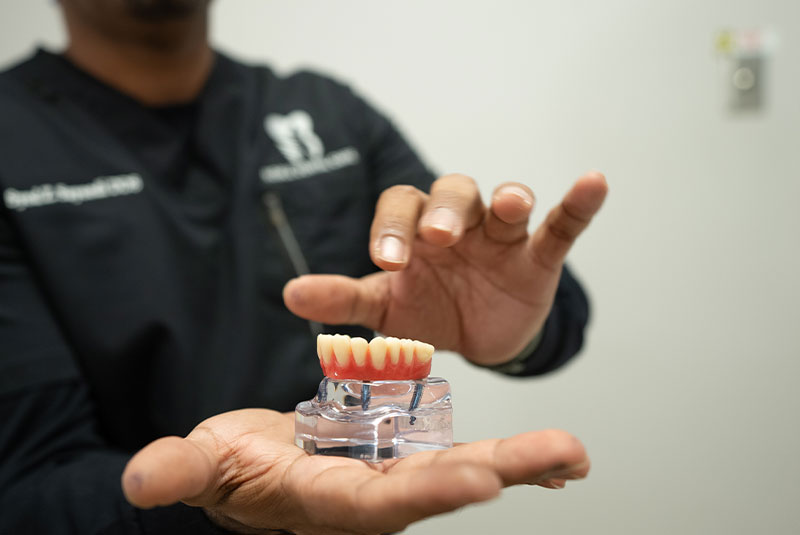 Dr. Sayeedi, Syed Zafar. holding a model of implants